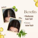 Kesh King Gold Ayurvedic Hair Oil with 21 Herbs & Gro-Biotin Hair Oil (200 ml) - Image 3